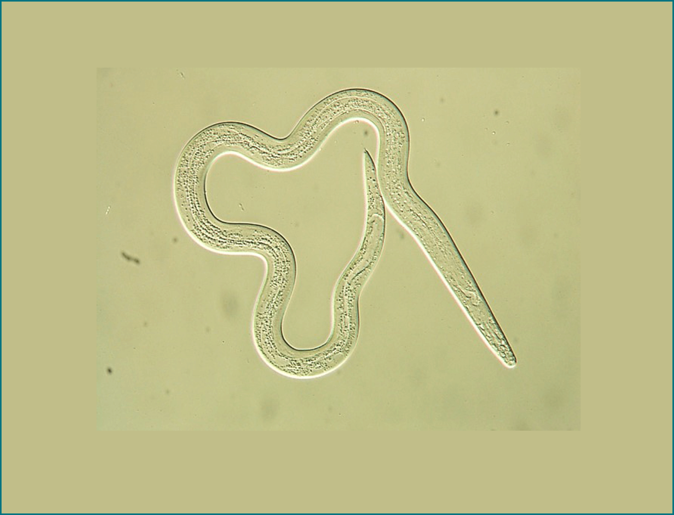 Microscope image of a nematode worm